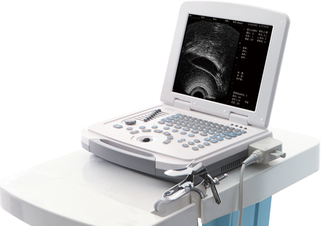  DW-400,全數字可視人流機,便攜式可視人流機