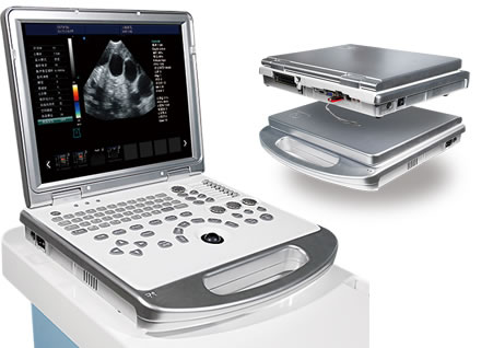 驢用B超機(jī),獸用b超,獸用孕檢B超,毛驢妊娠的直腸檢查法