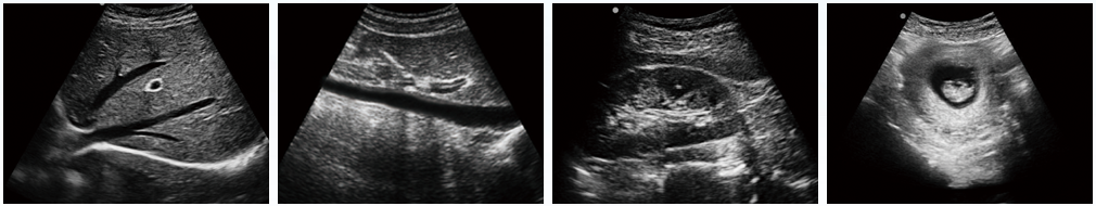 DW-360便攜式B超機(jī)臨床圖像
